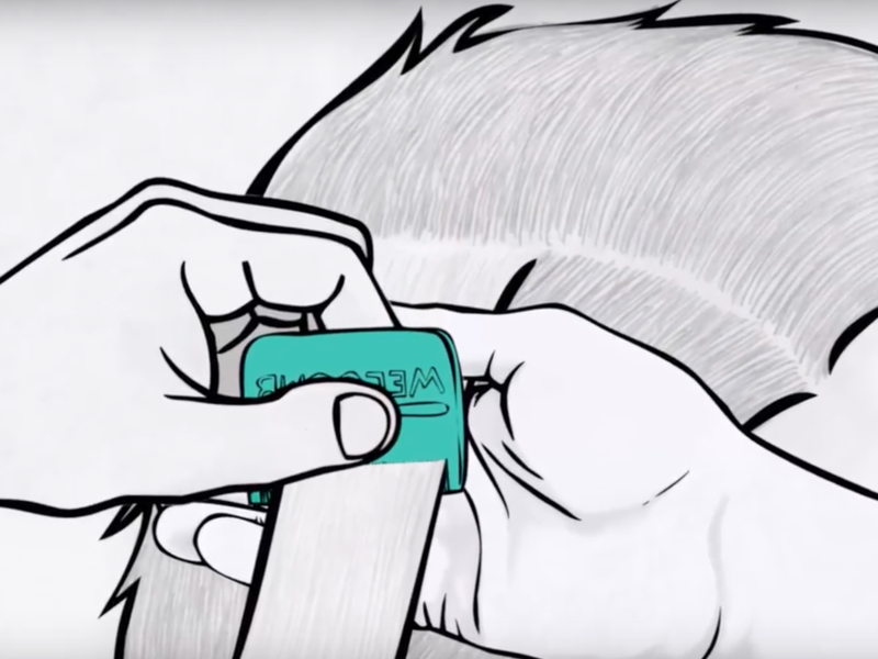 VIDEO: How to Remove Lice & Nits with WelComb®